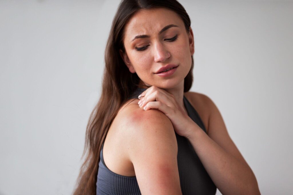 A picture of a woman having an allergic reaction to an insect bite